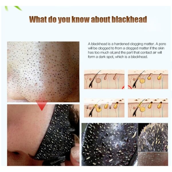 Black Head Remover Mask - Image 6
